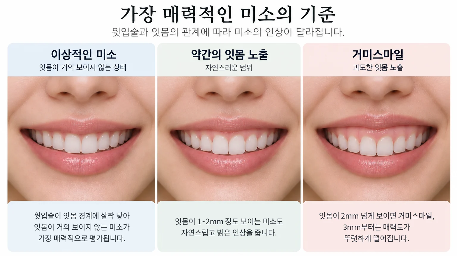 웃을 때 보이는 잇몸 양에 따른 미소 비교 모식도: 잇몸이 거의 보이지 않는 미소, 잇몸이 1~2mm 보이는 미소, 잇몸이 2mm 넘게 보이는 거미스마일